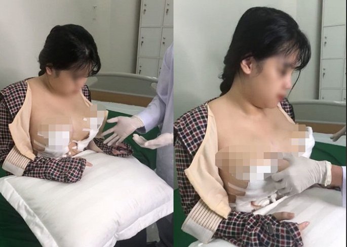 Lộ hình ảnh đầu tiên sau 4 ngày phẫu thuật của hotgirl ngực khủng ở Hải Dương
