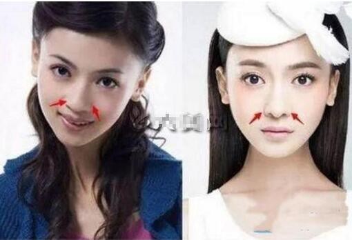 Ngụy Anh Lạc Ngô Cẩn Ngôn bị tố độn cằm, gọt mặt V-line, nhan sắc năm xưa khác xa bây giờ