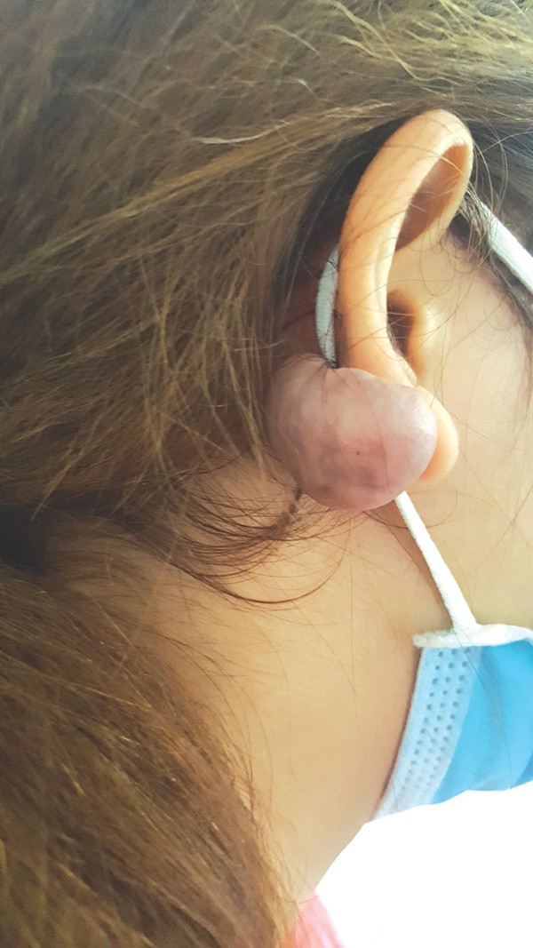 Lạm dụng filler, tế bào gốc xách tay: Làm đẹp biến thành thảm họa