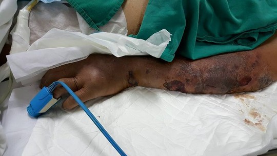 Sự thật khủng khiếp về tiết canh