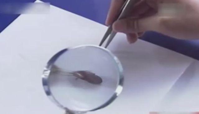 Người đàn ông chết sau 1 ngày nằm viện, thứ cướp đi sinh mạng của ông lại rất nhỏ bé