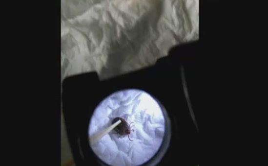 Người đàn ông chết sau 1 ngày nằm viện, thứ cướp đi sinh mạng của ông lại rất nhỏ bé