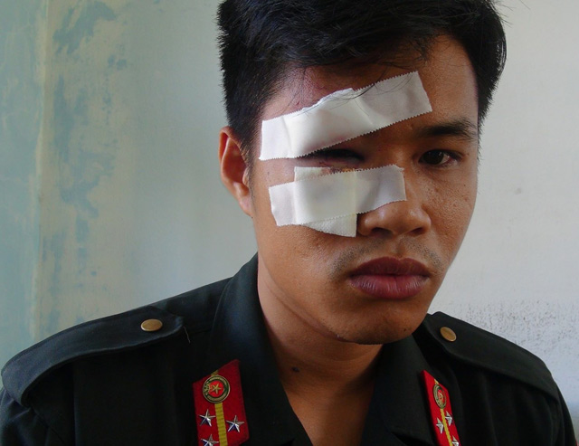 Quảng Ngãi: Tạm giữ hình sự 9 đối tượng chặn QL 1A, tấn công công an