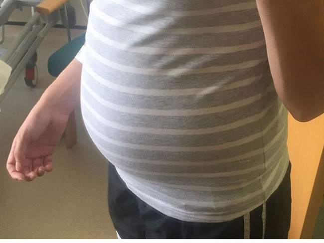 Mang tiếng không chồng mà chửa vì bụng to như mang bầu, người phụ nữ này đi khám mới chết lặng khi biết mắc phải bệnh cực nguy hiểm