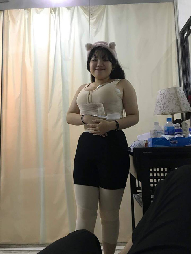 Nữ sinh siêu vòng 1 bất ngờ xuất hiện với thân hình eo ót sau khi hút 9 lít mỡ thừa