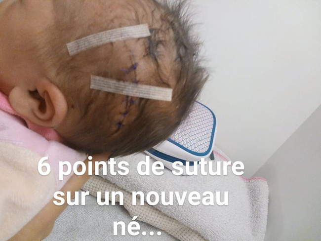 Bác sĩ rạch trúng đầu em bé trong ca sinh mổ, không xin lỗi còn nói rằng không nghiêm trọng