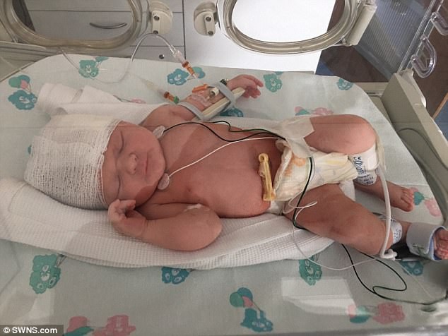 Bác sĩ rạch trúng đầu em bé trong ca sinh mổ, không xin lỗi còn nói rằng không nghiêm trọng