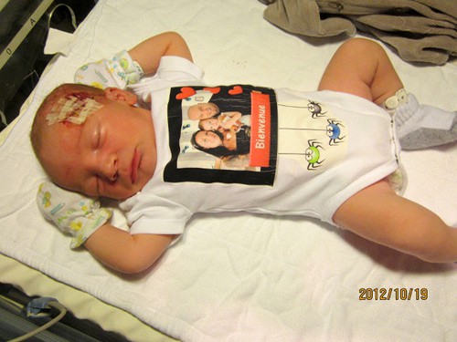 Bác sĩ rạch trúng đầu em bé trong ca sinh mổ, không xin lỗi còn nói rằng không nghiêm trọng