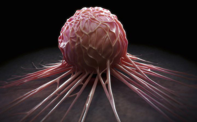 15 dấu hiệu báo ung thư đang rình rập nam giới: Nhớ để còn giúp người khác phát hiện sớm