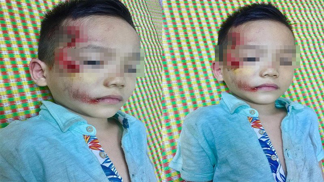 Y tá bỏ vào phòng ngồi nói chuyện điện thoại khi người nhà bệnh nhân không mang tiền