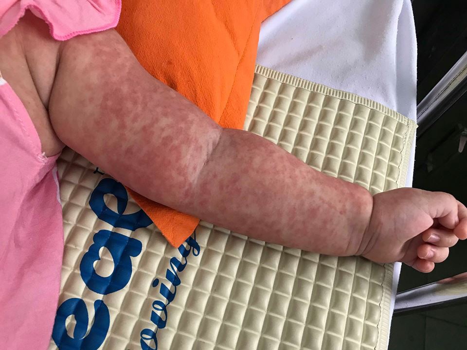 Lo ngại bùng phát dịch bệnh mùa tựu trường