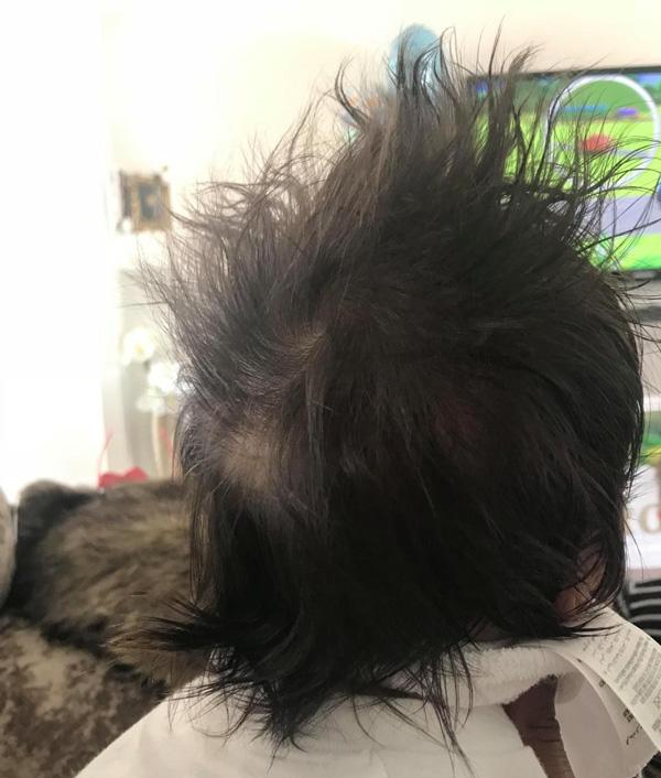 Cậu bé gây sốc cho bác sĩ đỡ đẻ với mái tóc có một không hai