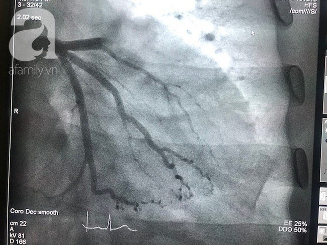 Đừng làm ngơ trước căn bệnh ảnh hưởng đến gần 20% người Việt dưới 80 tuổi, phụ nữ mang thai và sau khi sinh cũng có thể mắc!