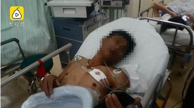 Nếu không muốn chia tay thì giao trái tim của anh cho em - sau câu nói tưởng như đùa của bạn gái, chàng trai bị moi tim suýt chết