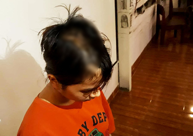 Thiếu nữ 14 tuổi kể lại thời khắc kinh hoàng khi bị nhóm thanh niên chặn đường truy sát giữa đêm ở Sài Gòn