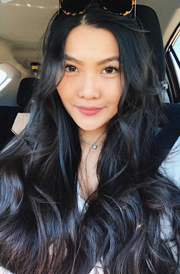 Hoa khôi Du học sinh Việt: Con gái học Y không chỉ hy sinh thanh xuân