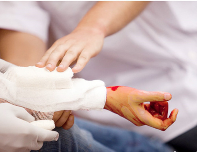 Trường hợp bị cứa đứt động mạch, làm thế nào để sơ cứu đúng chỉ trong vài phút sống còn?