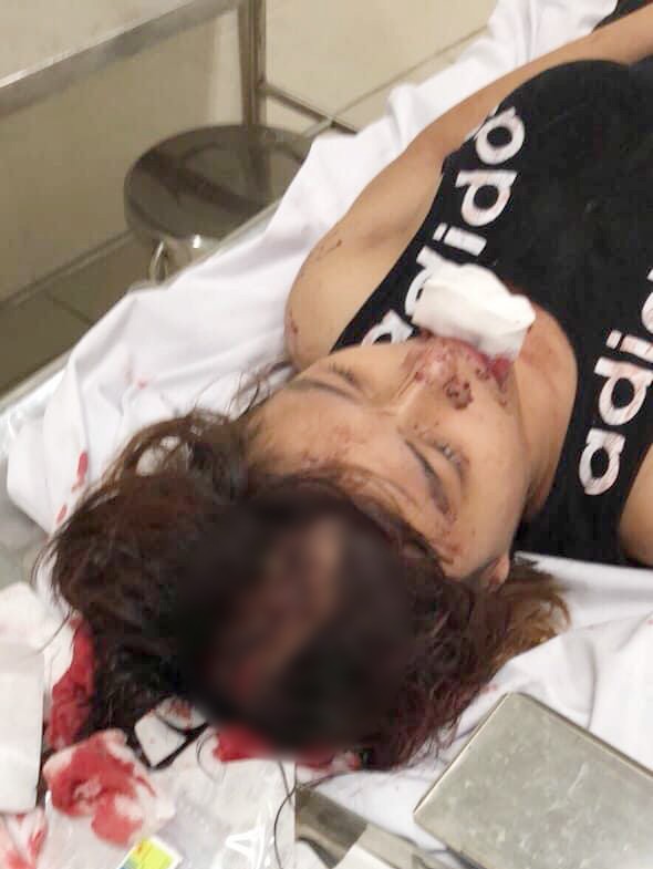 Công an thông tin bất ngờ vụ cô gái 14 tuổi bị nhóm thanh niên truy sát giữa đêm ở Sài Gòn