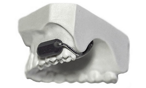 Mỹ chi 10 triệu USD để lắp bộ đàm trong hàm răng binh sĩ