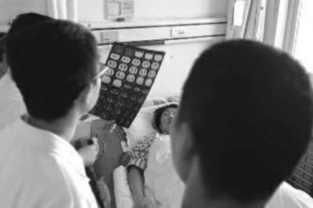 Người phụ nữ ăn ớt bị kẹt trong phổi suốt 6 năm mà không biết