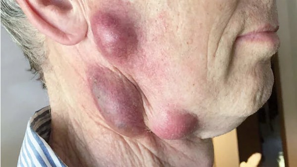 Người đàn ông suýt mất mạng vì làm điều này khi nuôi mèo, bác sĩ cảnh báo bệnh nguy hiểm ai cũng cần cảnh giác