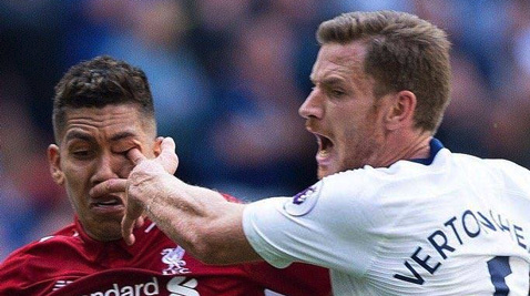 Firmino dính chấn thương vì bị... chọc vào mắt