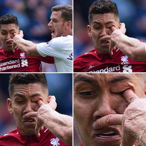 Firmino dính chấn thương vì bị... chọc vào mắt