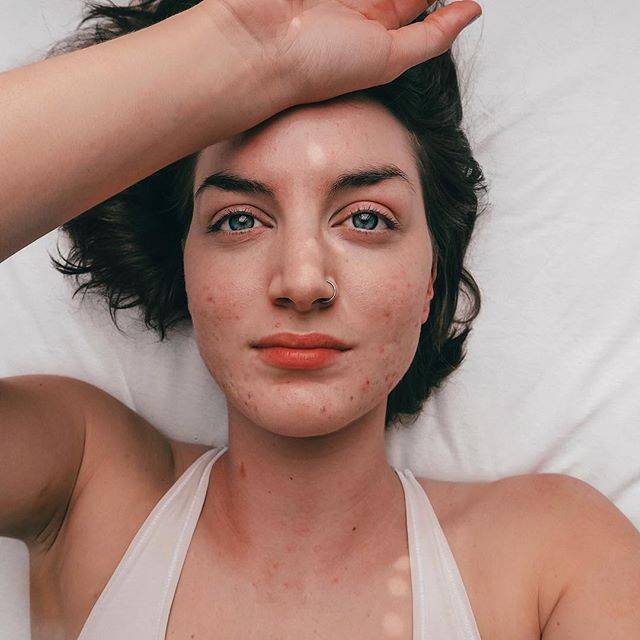 Bạn có biết: Tẩy da chết sai cách sẽ khiến da càng nhanh lão hóa hơn