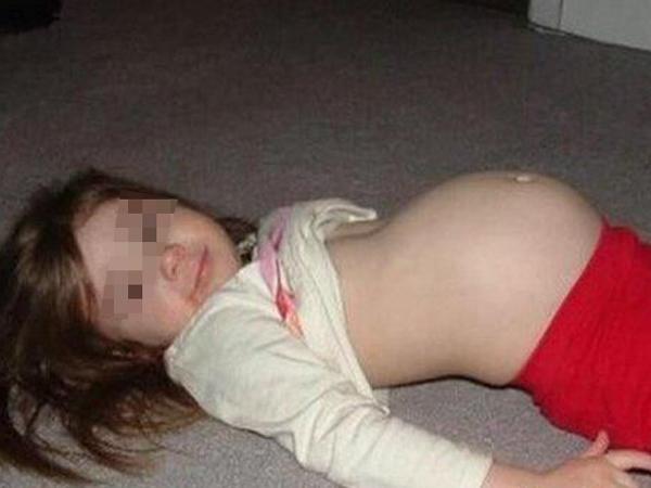 Con 10 tuổi bụng to bất thường, bố tưởng tuổi ăn tuổi lớn ai ngờ mang thai 8 tháng