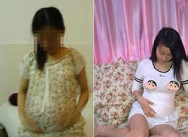 Con 10 tuổi bụng to bất thường, bố tưởng tuổi ăn tuổi lớn ai ngờ mang thai 8 tháng