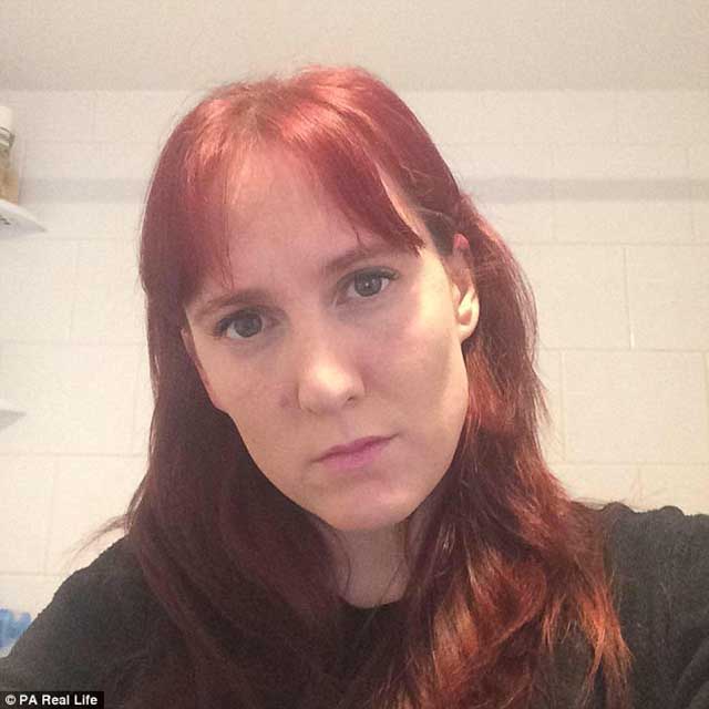 Không tháo kính áp tròng khi bơi, người phụ nữ này phải trả giá bằng con mắt của mình