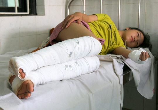 Tưới xăng vào người tình rồi ôm chặt tự thiêu Tưới xăng vào người tình rồi ôm chặt tự thiêu