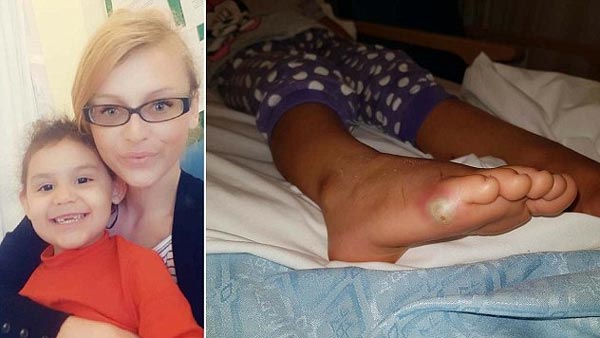 Bé 4 tuổi nguy kịch vì không đi tất khi thử giầy