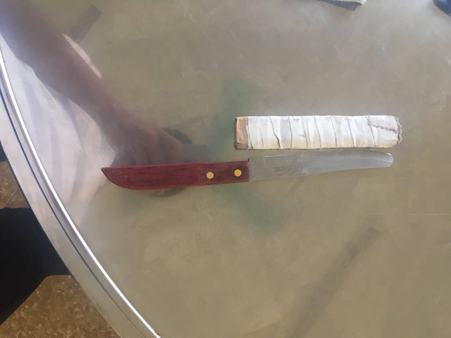 Vụ nữ nhân viên hộ lý bị chồng bạo hành: Đối tượng khai gì với cơ quan công an?