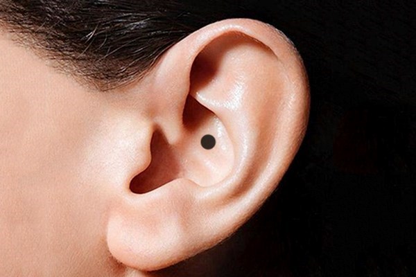 9 nốt ruồi đại phú quý ai có là người vô cùng may mắn