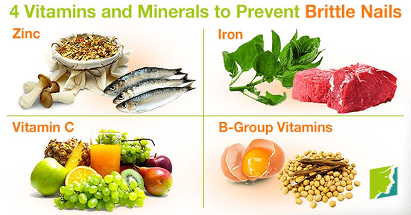 Móng tay giòn và dễ gãy bổ sung ngay 4 loại vitamin này