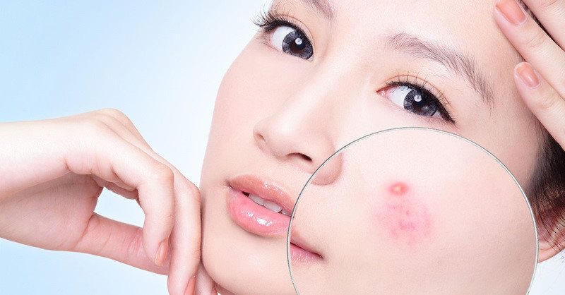 Những hồi chuông cảnh báo cơ thể bạn đang bị dư thừa đường Những hồi chuông cảnh báo cơ thể bạn đang bị dư thừa đường