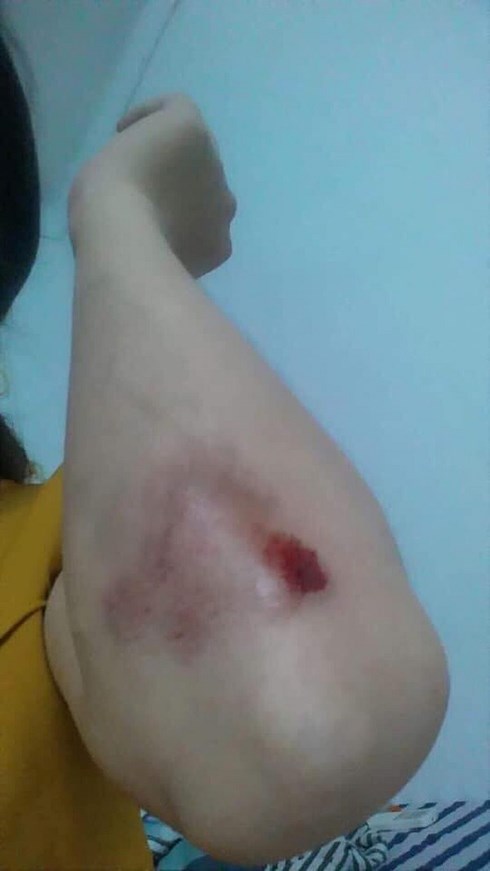 Có thể khởi tố vụ thanh niên đi SH đánh bà bầu 8 tháng?