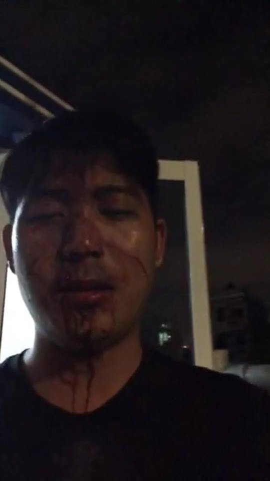 Cư dân Opal Riverside tố bị bảo vệ đánh gãy sống mũi