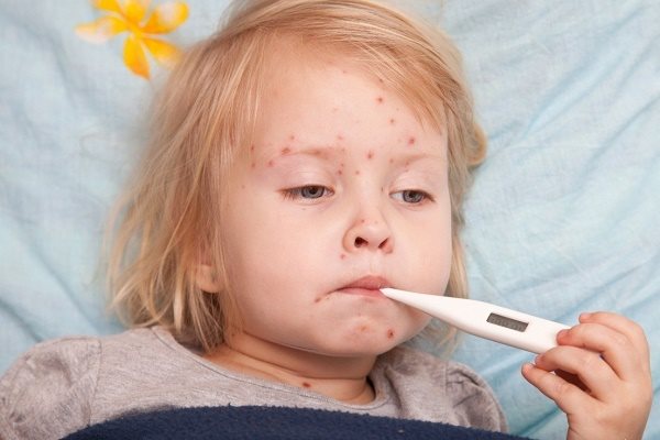 Những dịch bệnh hè – thu con hay gặp ở trường và cách phòng tránh Những dịch bệnh hè – thu con hay gặp ở trường và cách phòng tránh