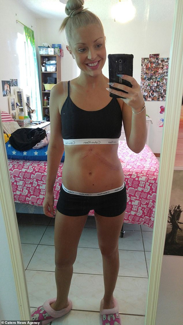 Người phụ nữ bị bệnh gan đã may mắn sống lại sau khi được thông báo chỉ còn sống vài ngày: Dấu hiệu bệnh không được bỏ qua