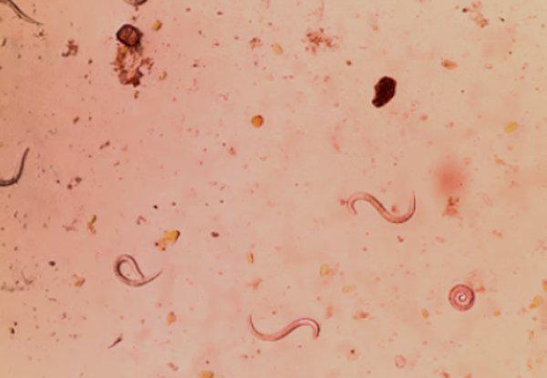 Thường xuyên trồng, chăm hoa, người phụ nữ hốt hoảng vì ho ra đờm toàn sinh vật lạ