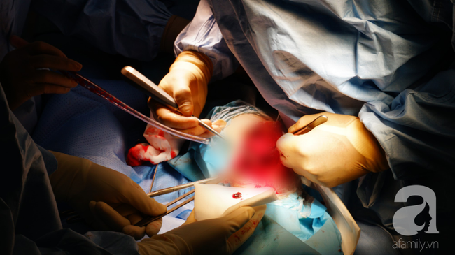 Nhất quyết không cho truyền máu người lạ, người phụ nữ ở TP.HCM suýt mất chân vì nhiều bệnh viện từ chối mổ