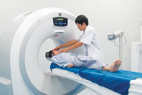 Nhận diện những cơn đau đầu nguy hiểm