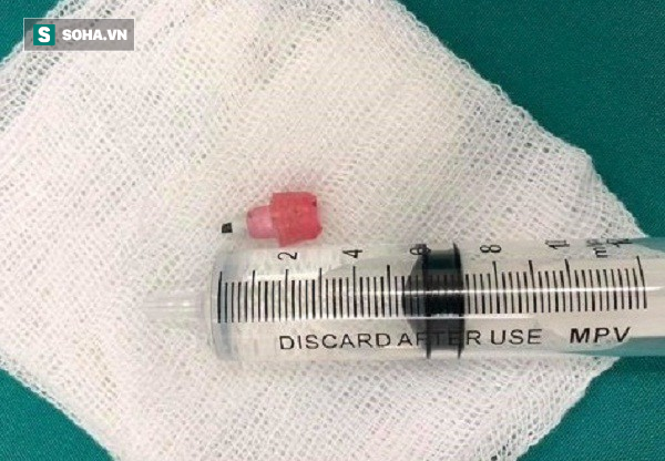 Ngồi học nuốt phải đầu bút chì, bé 6 tuổi toàn thân tím tái ngừng thở