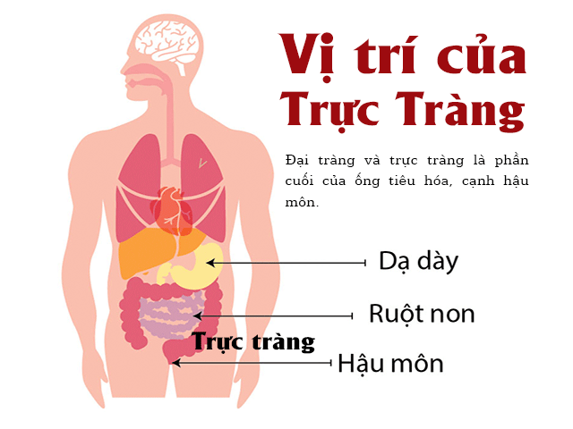 5 dấu hiệu điển hình cảnh báo khối u ung thư đại trực tràng đang phát triển thần tốc