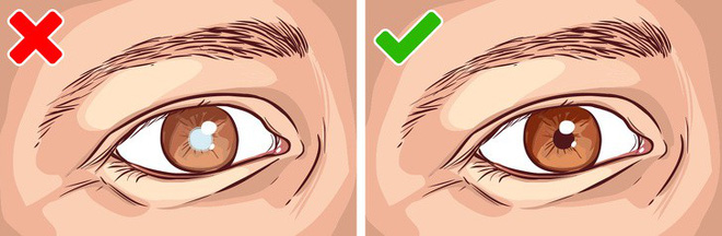 Thoái hóa cơ bắp bắt đầu với 8 triệu chứng sớm – đừng bỏ qua