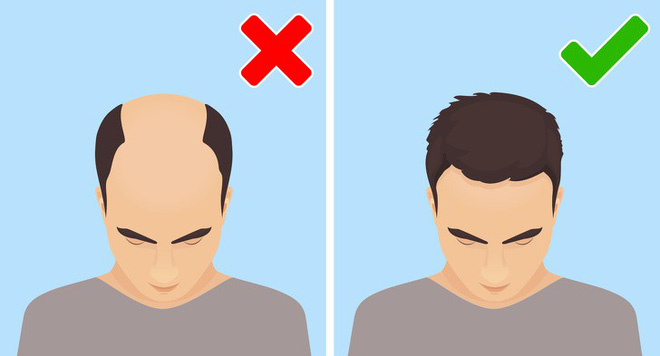 Thoái hóa cơ bắp bắt đầu với 8 triệu chứng sớm – đừng bỏ qua