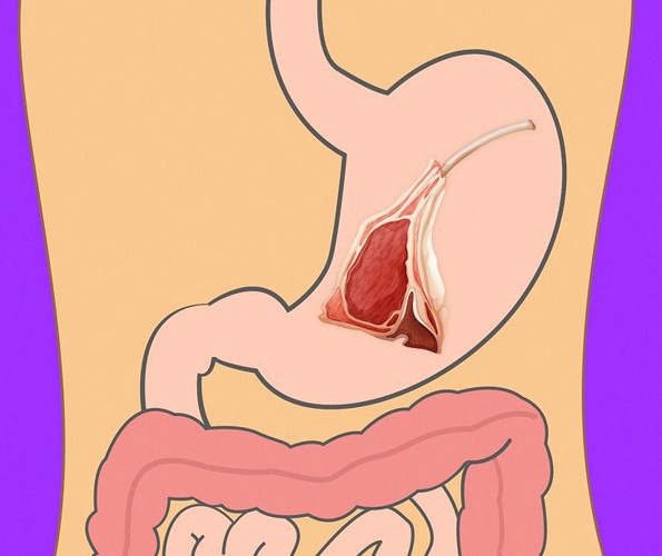 Mất bao lâu để tiêu hóa hết thực phẩm ăn hàng ngày?