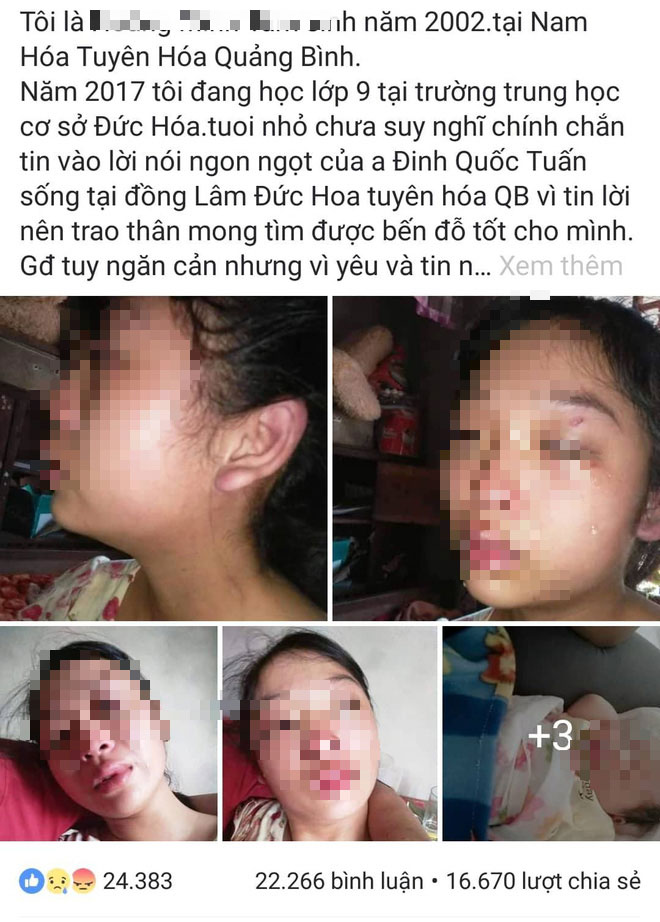 Vợ trẻ tố bị đánh đập dã man, chồng bị điều tra tội giao cấu với trẻ em